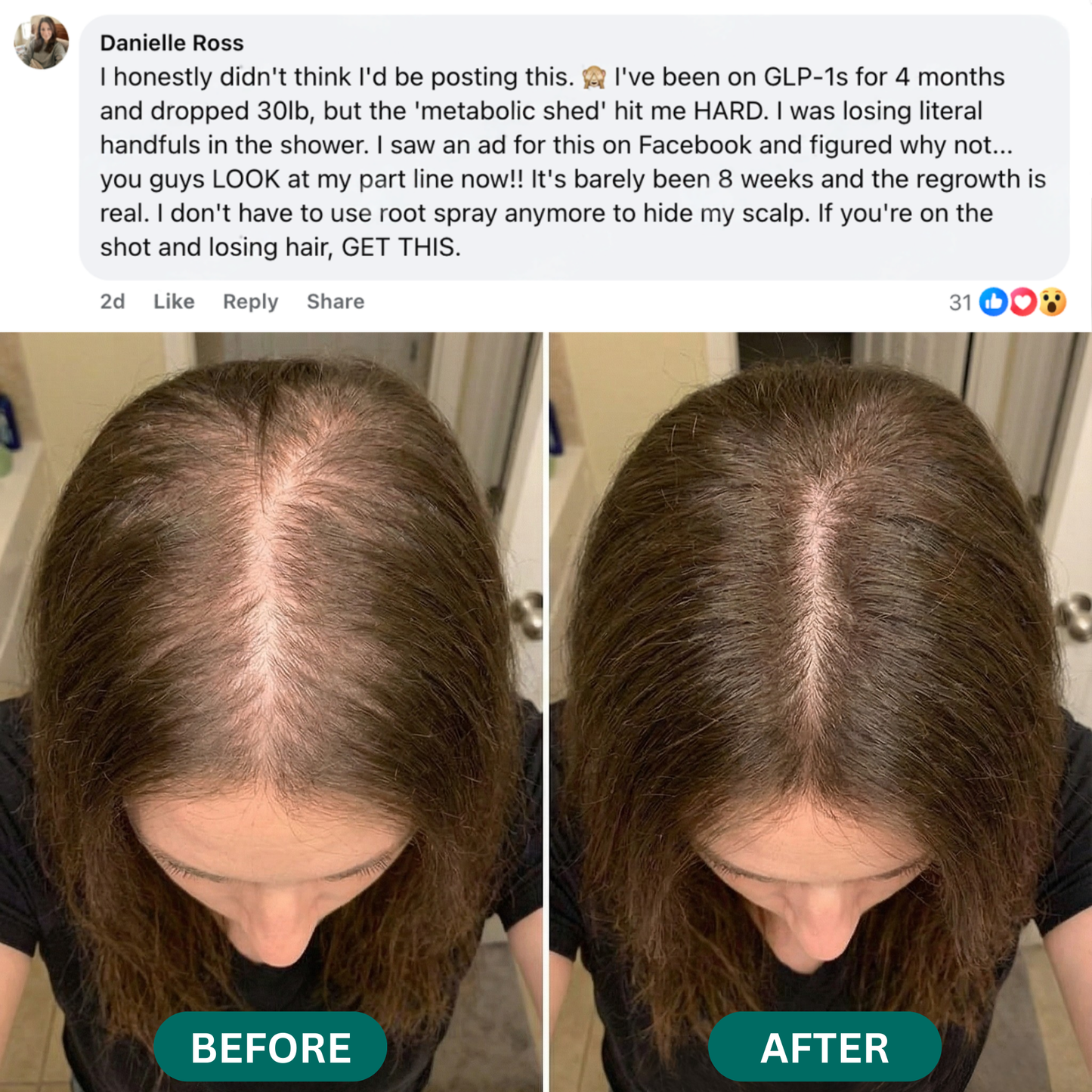 RESTORE Advanced Hair Complex
